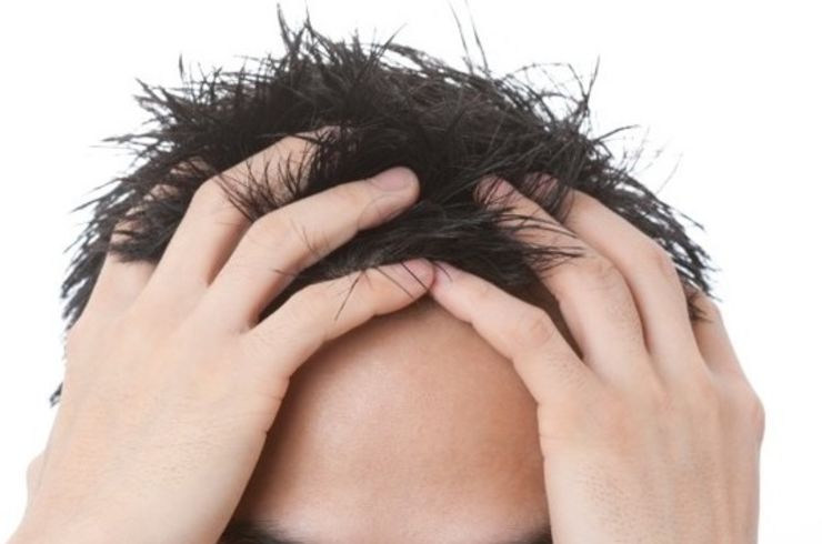 頭皮のさびとり（男性限定）