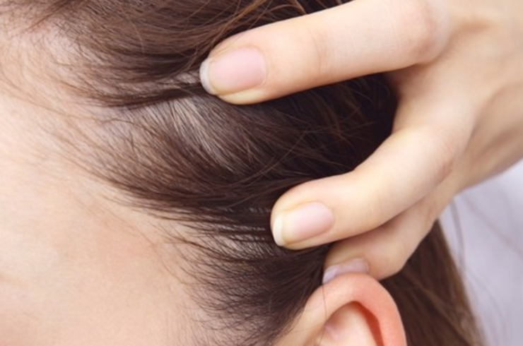 スキャルプエステ（女性限定）