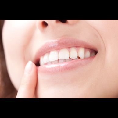 みなかみ町で白くなるセルフホワイトニングを行っております