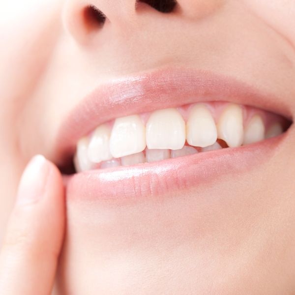 みなかみ町で白くなるセルフホワイトニングを行っております